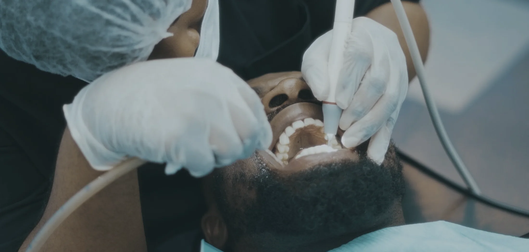 Treatment at the CrystalDent dental clinic